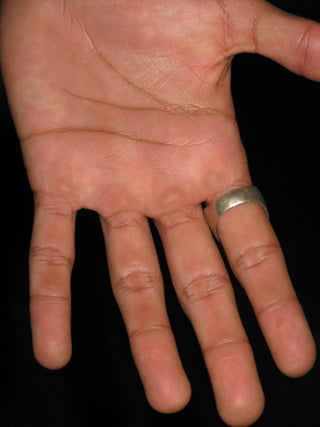 ANILLO ARMADURA